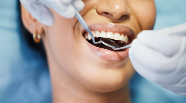 Best Broken or Cracked Tooth Emergency Dentist in Calhoun Falls, SC